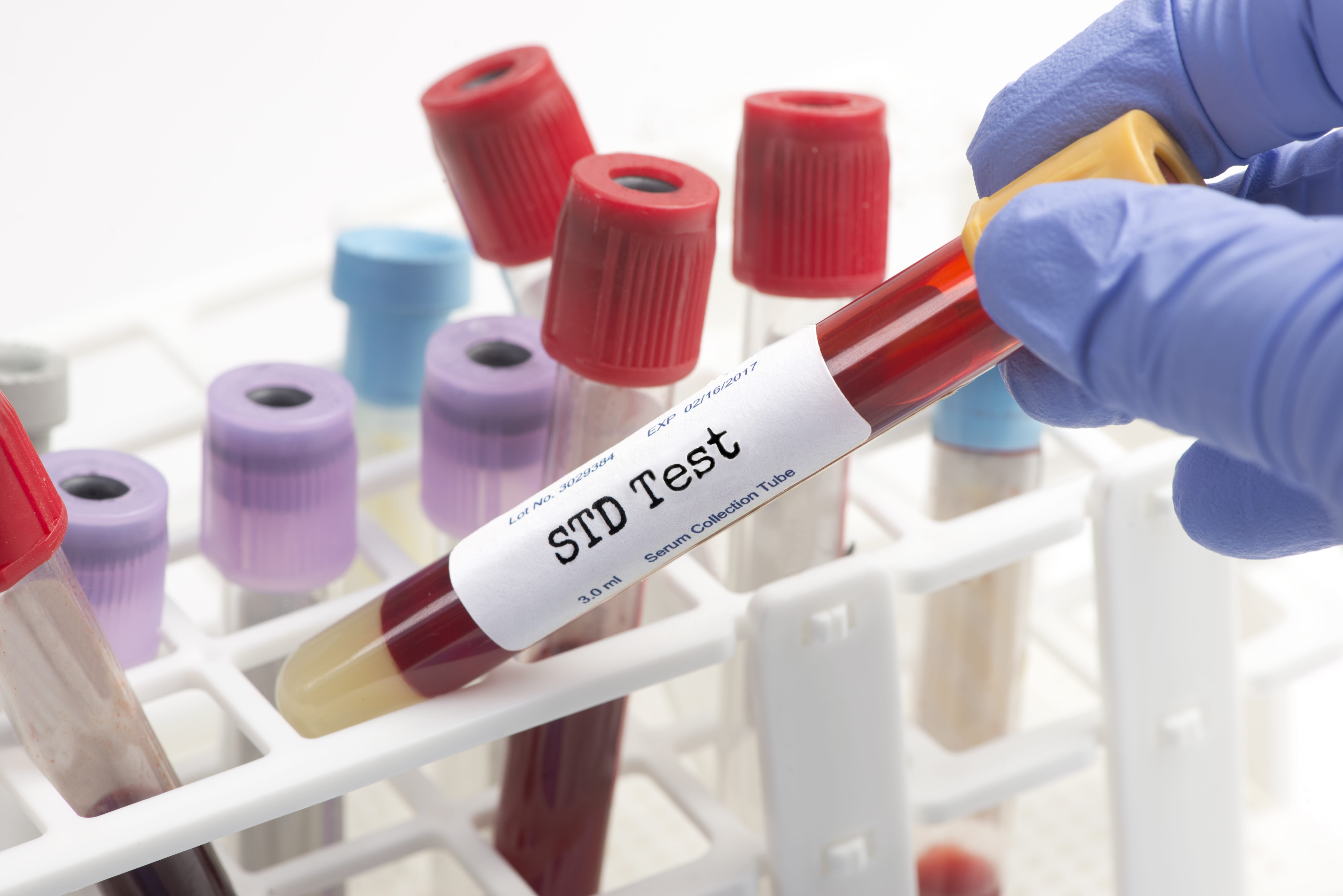 5 things you didn t know about stds next level urgent care